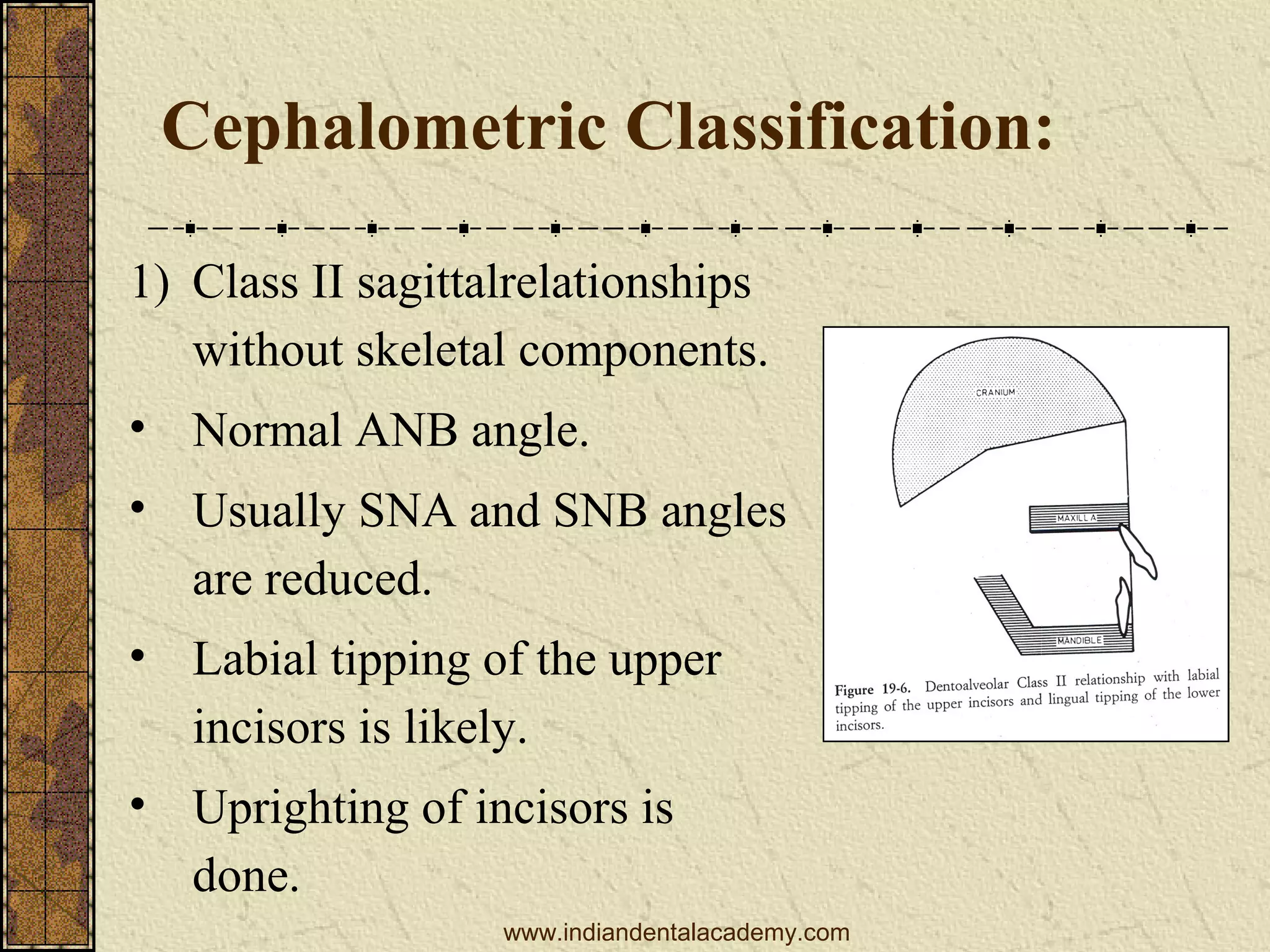 Cephalometric Classification:
1) Class II sagittalrelationships
without skeletal components.
• Normal ANB angle.
• Usually SNA and SNB angles
are reduced.
• Labial tipping of the upper
incisors is likely.
• Uprighting of incisors is
done.
www.indiandentalacademy.com

 
