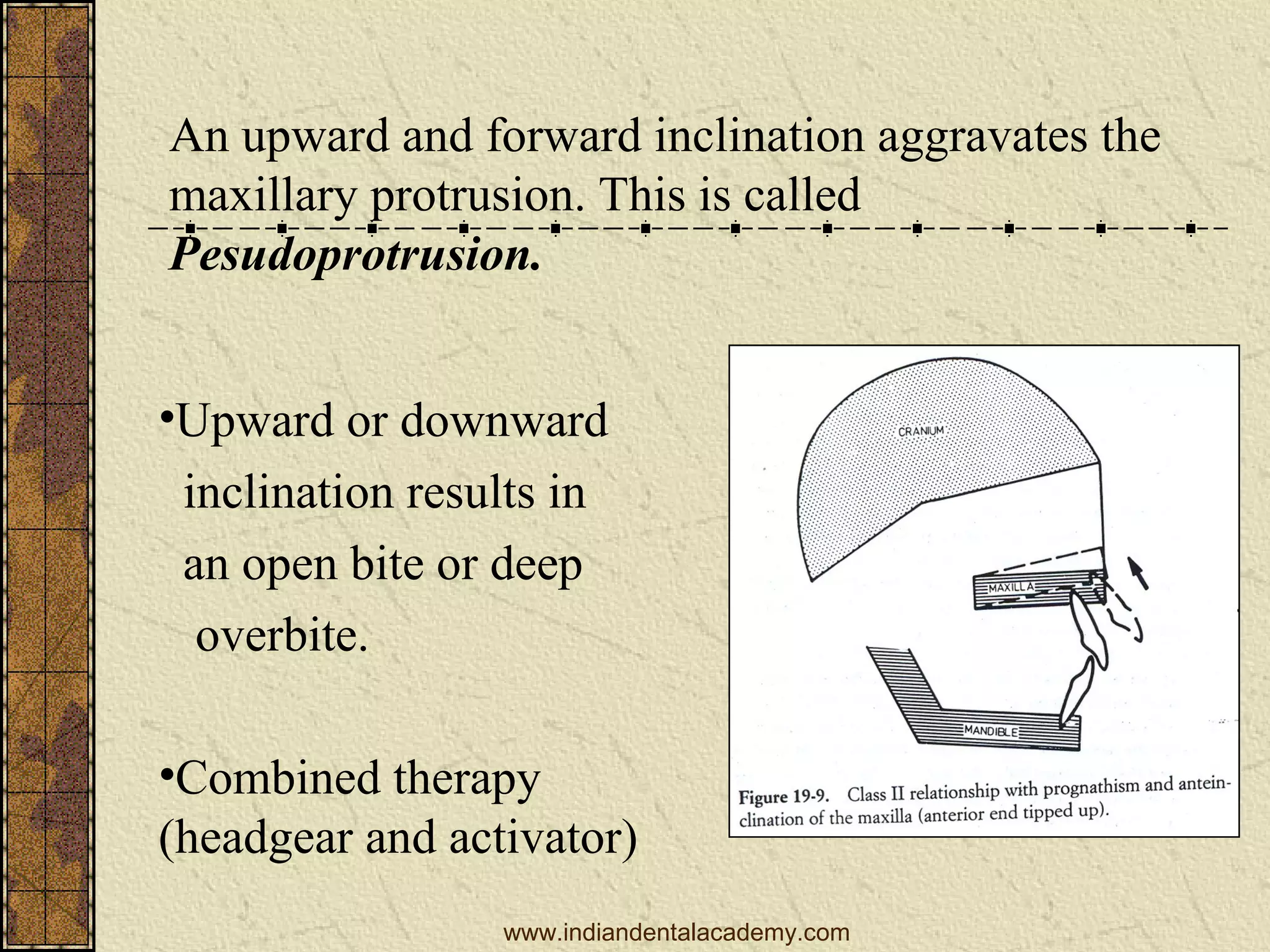 An upward and forward inclination aggravates the
maxillary protrusion. This is called
Pesudoprotrusion.
•Upward or downward
inclination results in
an open bite or deep
overbite.
•Combined therapy
(headgear and activator)
www.indiandentalacademy.com

 