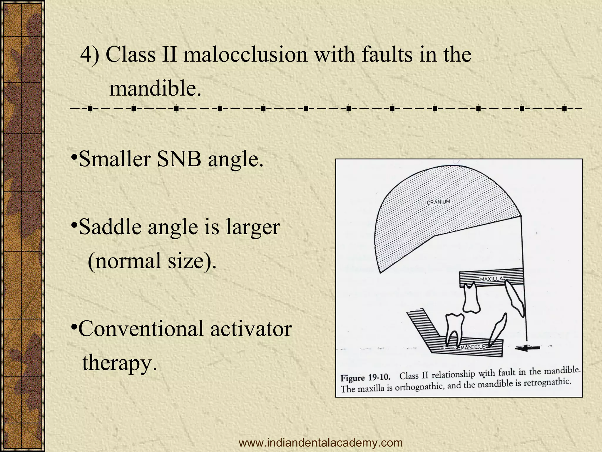 4) Class II malocclusion with faults in the
mandible.
•Smaller SNB angle.
•Saddle angle is larger
(normal size).
•Conventional activator
therapy.

www.indiandentalacademy.com

 