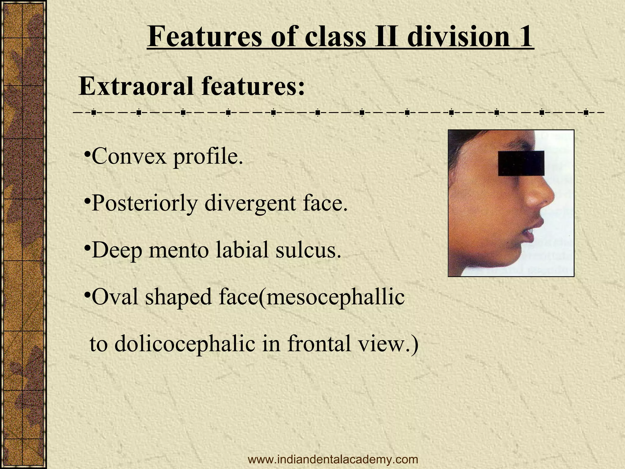 Features of class II division 1
Extraoral features:
•Convex profile.
•Posteriorly divergent face.
•Deep mento labial sulcus.
•Oval shaped face(mesocephallic
to dolicocephalic in frontal view.)

www.indiandentalacademy.com

 