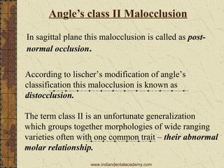 Angle’s class II Malocclusion
In sagittal plane this malocclusion is called as postnormal occlusion.
According to lischer’s modification of angle’s
classification this malocclusion is known as
distocclusion.
The term class II is an unfortunate generalization
which groups together morphologies of wide ranging
varieties often with one common trait – their abnormal
molar relationship.
www.indiandentalacademy.com

 