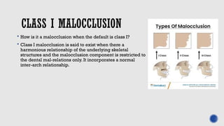 Class onyyyyyyyyyyyyyy Malocclusion.pptx