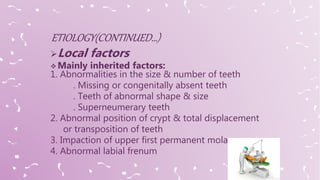 Local factors
 Mainly inherited factors:
1. Abnormalities in the size & number of teeth
. Missing or congenitally absent teeth
. Teeth of abnormal shape & size
. Superneumerary teeth
2. Abnormal position of crypt & total displacement
or transposition of teeth
3. Impaction of upper first permanent molars
4. Abnormal labial frenum
 