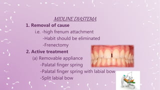 1. Removal of cause
i.e. -high frenum attachment
-Habit should be eliminated
-Frenectomy
2. Active treatment
(a) Removable appliance
-Palatal finger spring
-Palatal finger spring with labial bow
-Split labial bow
 