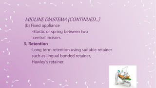 (b) Fixed appliance
-Elastic or spring between two
central incisors.
3. Retention
-Long term retention using suitable retainer
such as lingual bonded retainer,
Hawley’s retainer.
 