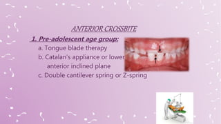 1. Pre-adolescent age group:
a. Tongue blade therapy
b. Catalan’s appliance or lower
anterior inclined plane
c. Double cantilever spring or Z-spring
 