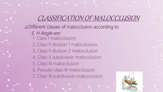  Different classes of malocclusion according to
E. H Angle are:
1. Class I malocclusion
2. Class II division 1 malocclusion
3. Class II division 2 malocclusion
4. Class II subdivision malocclusion
5. Class III malocclusion
6. Pseudo-class III malocclusion
7. Class III subdivision malocclusion.
 