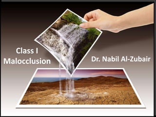 Class I
Malocclusion Dr. Nabil Al-Zubair
 