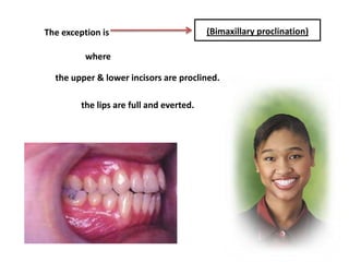The exception is (Bimaxillary proclination)
where
the upper & lower incisors are proclined.
the lips are full and everted.
 