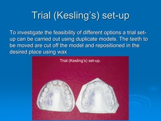 Trial (Kesling’s) set-up
To investigate the feasibility of different options a trial set-
up can be carried out using duplicate models. The teeth to
be moved are cut off the model and repositioned in the
desired place using wax
Trial (Kesling’s) set-up.
 