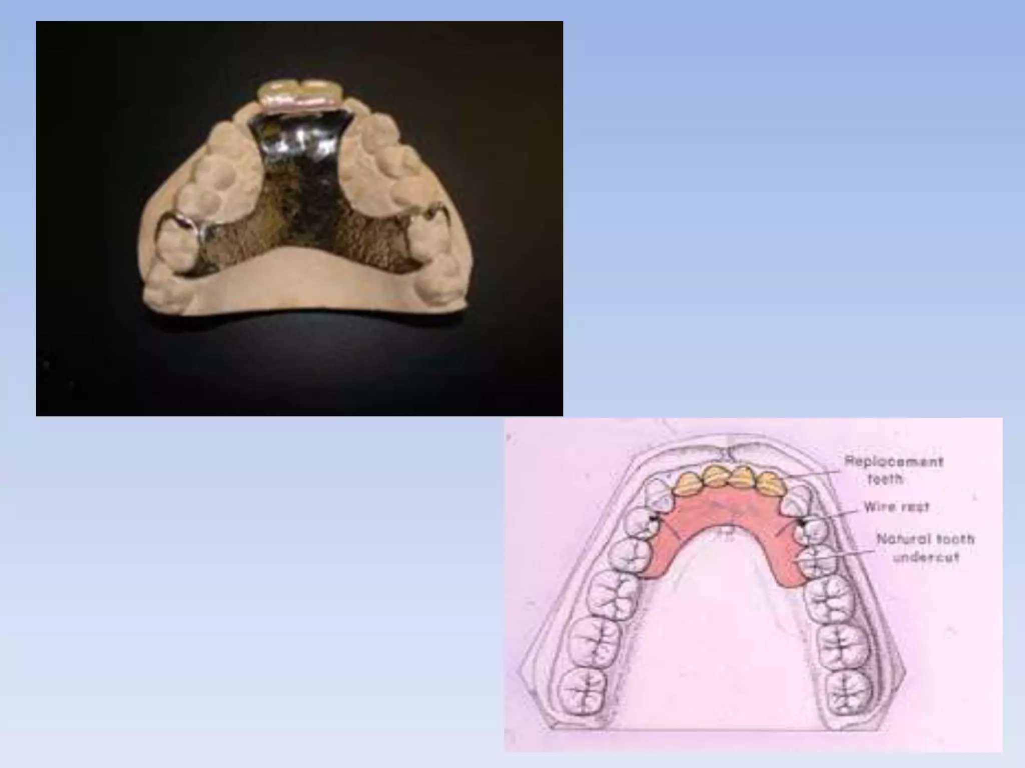 Interiem Rpd kennedy class IV | PPTX