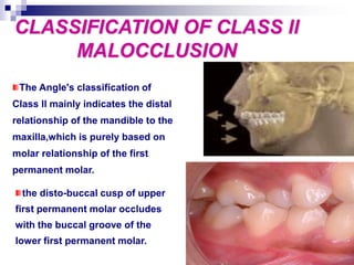 Classification 2 Lessive Classll etiology and management | PPT