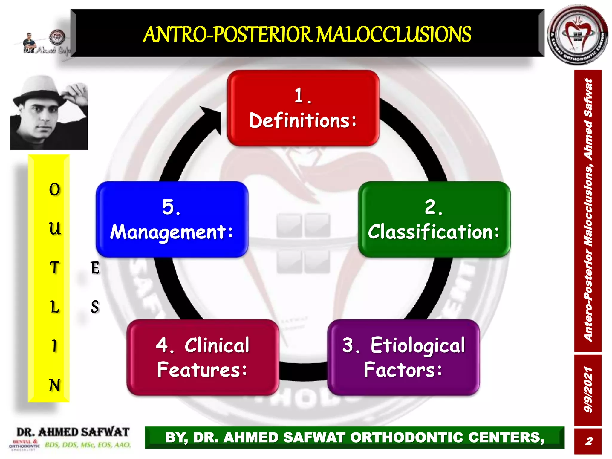 Orthodontic Management of Class ll malocclusion by Ahmed Safwat | PPTX