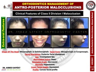 9/9/2021
Antero-Posterior
Malocclusions,
Ahmed
Safwat
15
Clinical Features of Class II Division I Malocclusion
ORTHODONTIC...