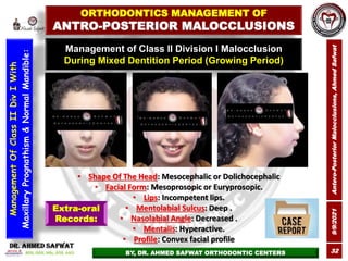 9/9/2021
Antero-Posterior
Malocclusions,
Ahmed
Safwat
32
Management of Class II Division I Malocclusion
During Mixed Denti...