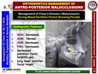 9/9/2021
Antero-Posterior
Malocclusions,
Ahmed
Safwat
35
Management of Class II Division I Malocclusion
During Mixed Denti...