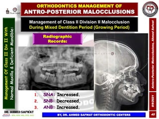 9/9/2021
Antero-Posterior
Malocclusions,
Ahmed
Safwat
45
Management of Class II Division II Malocclusion
During Mixed Dent...