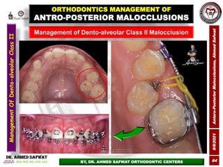 9/9/2021
Antero-Posterior
Malocclusions,
Ahmed
Safwat
64
Management of Dento-alveolar Class II Malocclusion
ORTHODONTICS M...