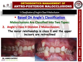9/9/2021
Antero-Posterior
Malocclusions,
Ahmed
Safwat
8
I. Classification of Angle's Class II Malocclusion
 Based On Angl...