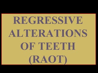 Rao R T Class on regresive altrations of teeth (RAOT) | PPT