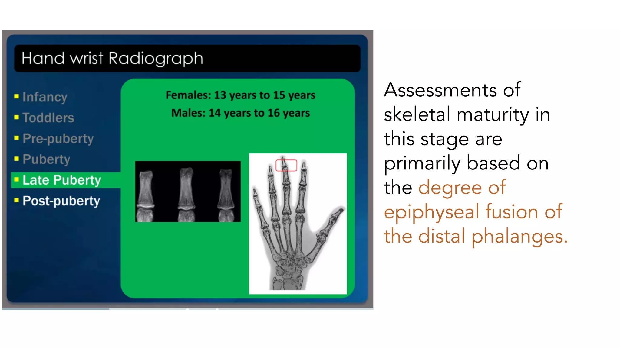 BONE AGE ESTIMATION | PDF