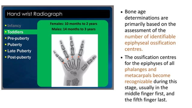 BONE AGE ESTIMATION | PDF | Death, Injury, or Military Conflict ...