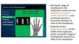 • During this stage of
development, the
ossification centers for the
epiphyses increase in
width and thickness, and
eventually assume a
transverse diameter as
wide as the metaphyses.
• Depiction of the
progressive growth of the
width of the epiphyses,
which, during this stage of
development, become as
wide as the metaphysis.
 