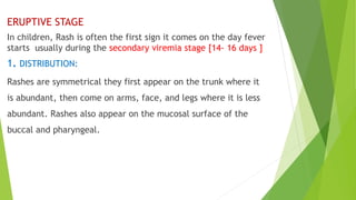 ERUPTIVE STAGE
In children, Rash is often the first sign it comes on the day fever
starts usually during the secondary viremia stage [14- 16 days ]
1. DISTRIBUTION:
Rashes are symmetrical they first appear on the trunk where it
is abundant, then come on arms, face, and legs where it is less
abundant. Rashes also appear on the mucosal surface of the
buccal and pharyngeal.
 