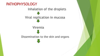 PATHOPHYSOLOGY
Inhalation of the droplets
Viral replication in mucosa
Viremia
Dissemination to the skin and organs
 