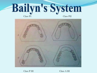 Class P1 Class PII
Class P III Class A III
 