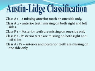 Class A 1 – a missing anterior tooth on one side only.
Class A 2 – anterior teeth missing on both right and left
sides.
Class P 1 – Posterior teeth are missing on one side only
Class P 2- Posterior teeth are missing on both right and
left sides
Class A 1 P1 – anterior and posterior teeth are missing on
one side only.
 