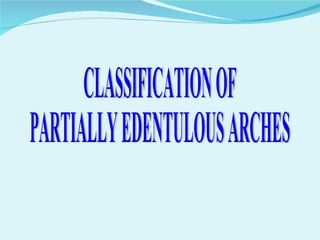 CLASSIFICATION OF  PARTIALLY EDENTULOUS ARCHES 