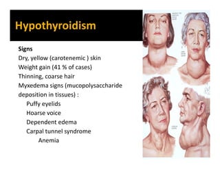 Primary Hypothyroidism
Autoimmune : most common
Some have lymphocytic infiltration variant
Post surgical thyroidectomy
Ext...
