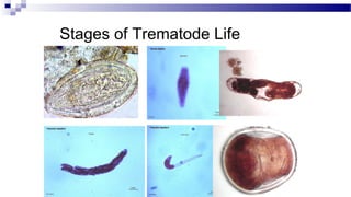 Stages of Trematode Life
Cycle

.
 