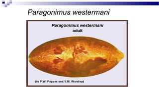 Paragonimus westermani
 