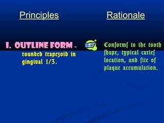 Principles Rationale 
I. OUTLINE FORM - 
rounded trapezoid in 
gingival 1/3. 
Conforms to the tooth 
shape, typical caries 
location, and site of 
plaque accumulation. 
 