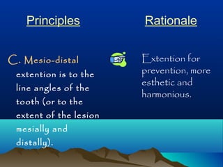 Principles Rationale 
C. Mesio-distal 
extention is to the 
line angles of the 
tooth (or to the 
extent of the lesion 
mesially and 
distally). 
Extention for 
prevention, more 
esthetic and 
harmonious. 
 