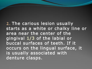 2. The carious lesion usually 
starts as a white or chalky line or 
area near the center of the 
gingival 1/3 of the labial or 
buccal surfaces of teeth. If it 
occurs on the lingual surface, it 
is usually associated with 
denture clasps. 
 