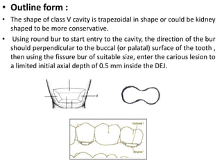 • Outline form :
• The shape of class V cavity is trapezoidal in shape or could be kidney
shaped to be more conservative.
...