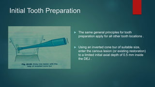 Initial Tooth Preparation
 The same general principles for tooth
preparation apply for all other tooth locations .
 Using an inverted cone bur of suitable size,
enter the carious lesion (or existing restoration)
to a limited initial axial depth of 0.5 mm inside
the DEJ .
 