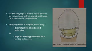  use the air syringe to remove visible moisture
(do not desiccate tooth structure), and inspect
the preparation for completeness.
 If the preparation is complete, either apply :
 desensitizer (for a non-bonded
restoration)
or
 begin the bonding procedures (for a
bonded restoration).
 
