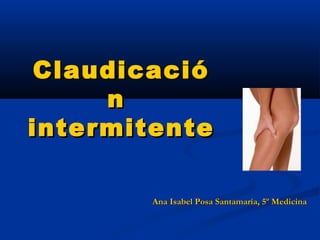ClaudicacióClaudicació
nn
intermitenteintermitente
Ana Isabel Posa Santamaría, 5º MedicinaAna Isabel Posa Santamaría, 5º Medicina
 