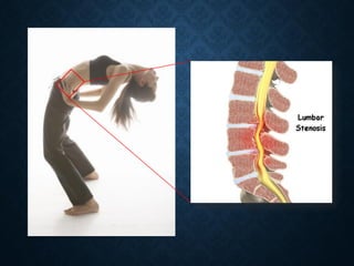 Cardanic Rigidity Topic of Vascular Claudication | PDF