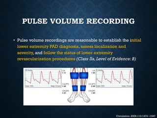 Topic of Vascular Claudication | PDF