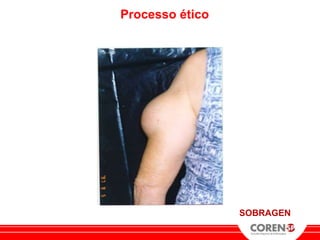Processo ético




                 SOBRAGEN
 