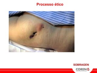 Processo ético




                 SOBRAGEN
 