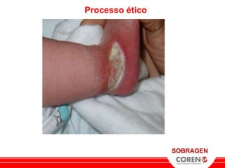 Processo ético




                 SOBRAGEN
 