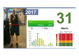 C55H10406
31
Hba1c
2017
 