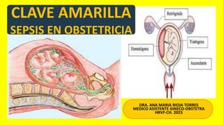 DRA. ANA MARIA RIOJA TORRES
MEDICO ASISTENTE GINECO-OBSTETRA
HRVF-CH. 2023
CLAVE AMARILLA
SEPSIS EN OBSTETRICIA
 