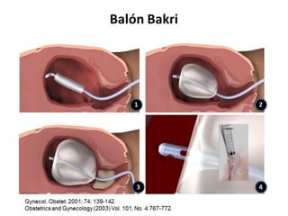 CLAVE ROJA 2023.pptx